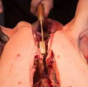 splitting hog spine